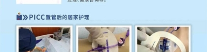 “小”护士，“大”能量！上海蓝十字脑科医院开设护理专科门诊